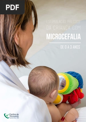 Estimulação Precoce da criança com microcefalia de 0 a 3 años