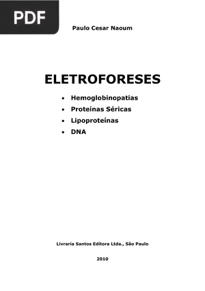 Eletroforeses