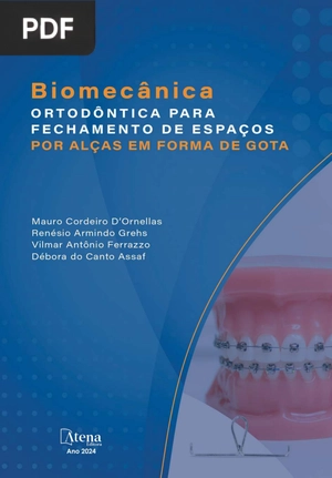 Biomecânica Ortodôntica para fechamento de espaços por alças em forma de gota