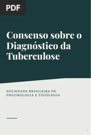 Consenso sobre o Diagnóstico da Tuberculose