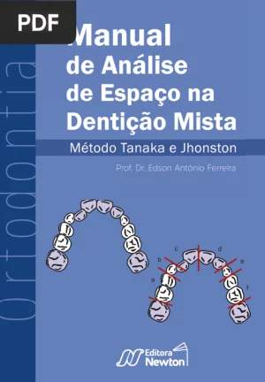 Manual de Análise de Espaço na Dentição Mista: Método Tanaka e Jhonston