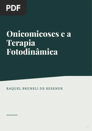 Onicomicoses e a Terapia Fotodinâmica