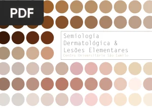 Semiologia Dermatológica e Lesões Elementares